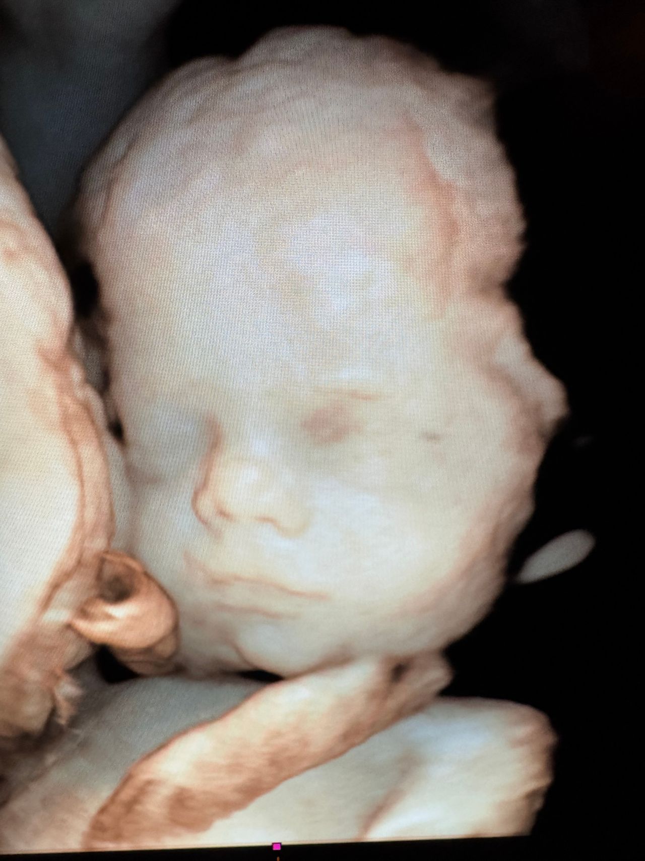 Marsiglietti Carlo-2