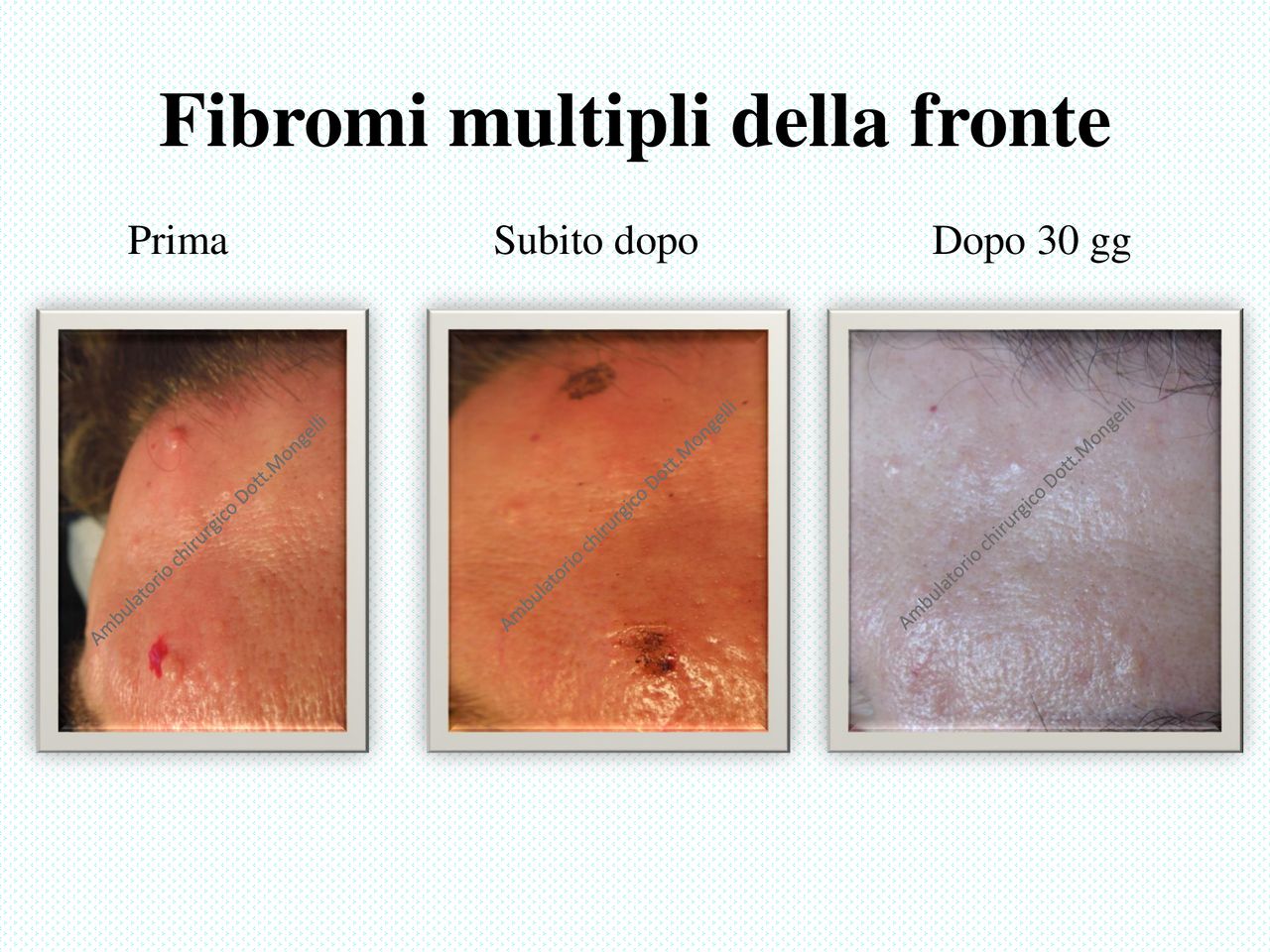 Matteo Antonio Mongelli-16