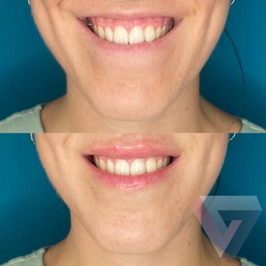 Victoria Trasmonte-42