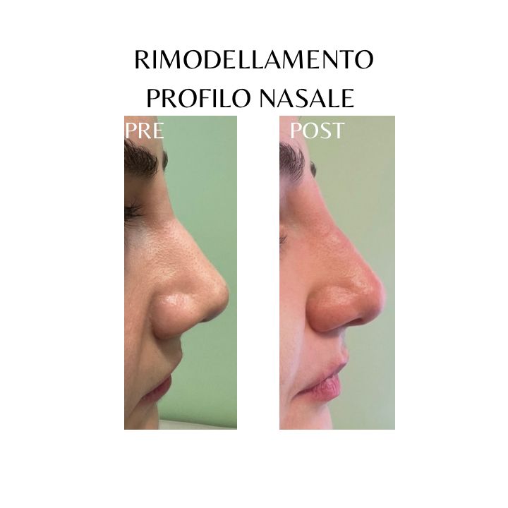 Giovanni Migliorini-14