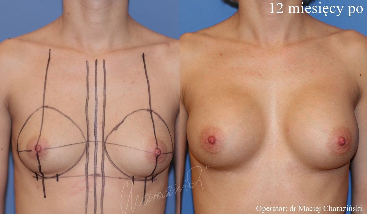 Maciej Charaziński-106