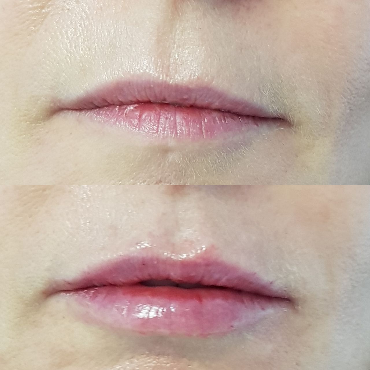 Rosalba Herrero Zerpa-193