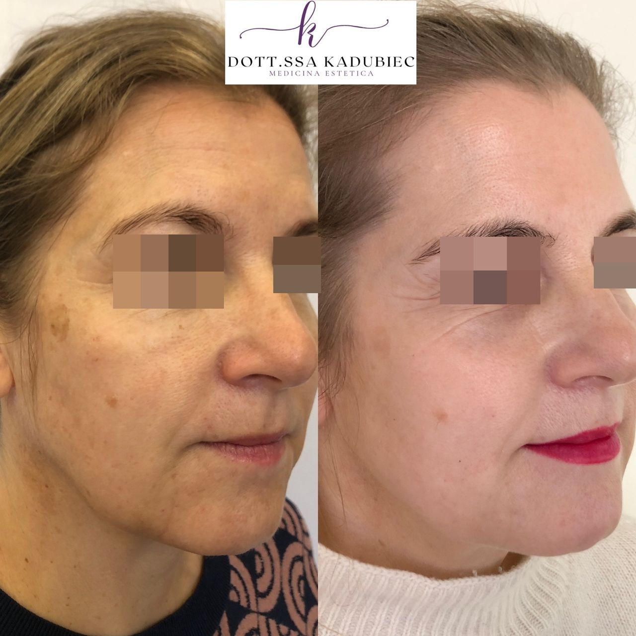 Aleksandra Kadubiec-4