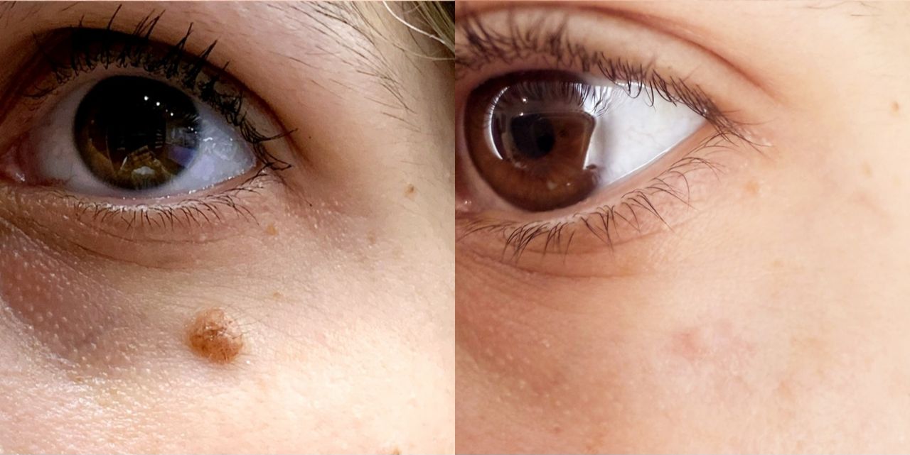 Rosalba Herrero Zerpa-517