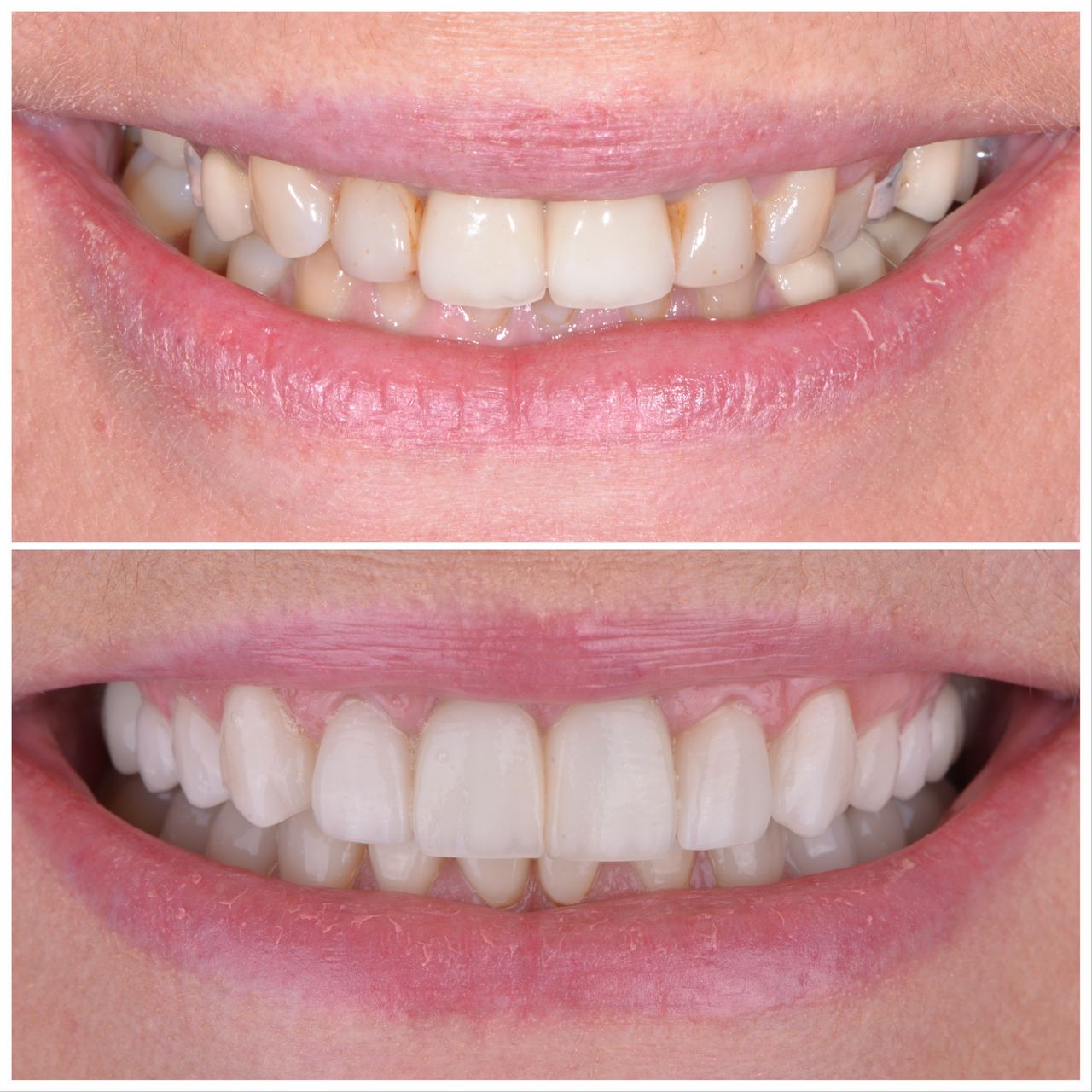 Martin Bartoszcze-22