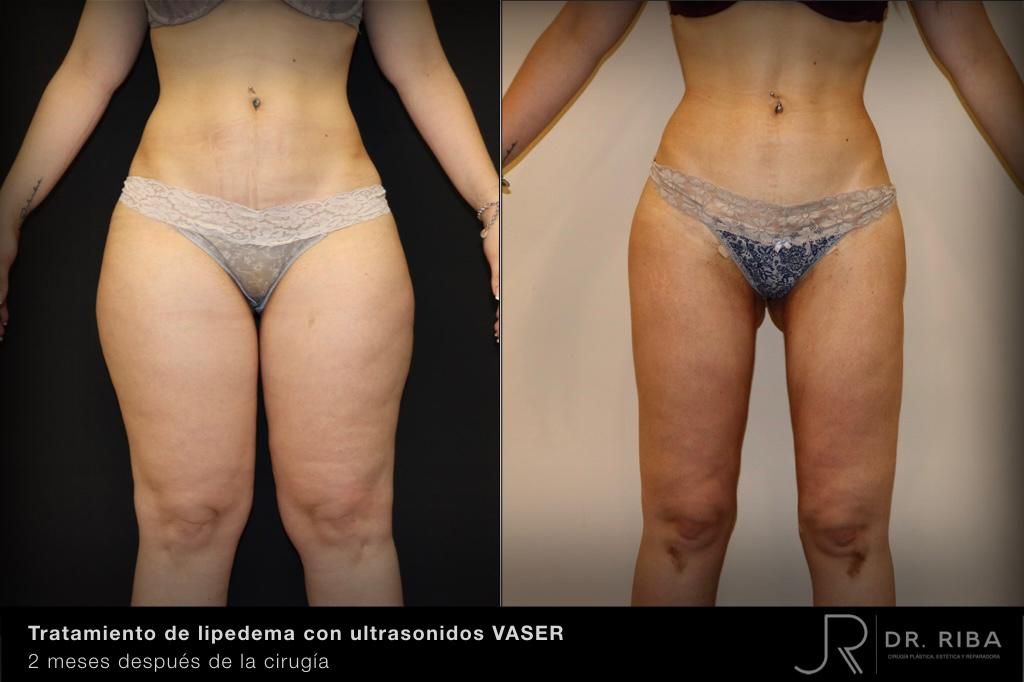 Jordi Riba Vilchez-17