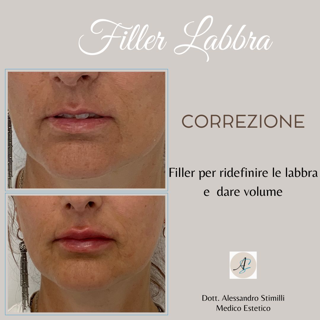 Alessandro Stimilli-18