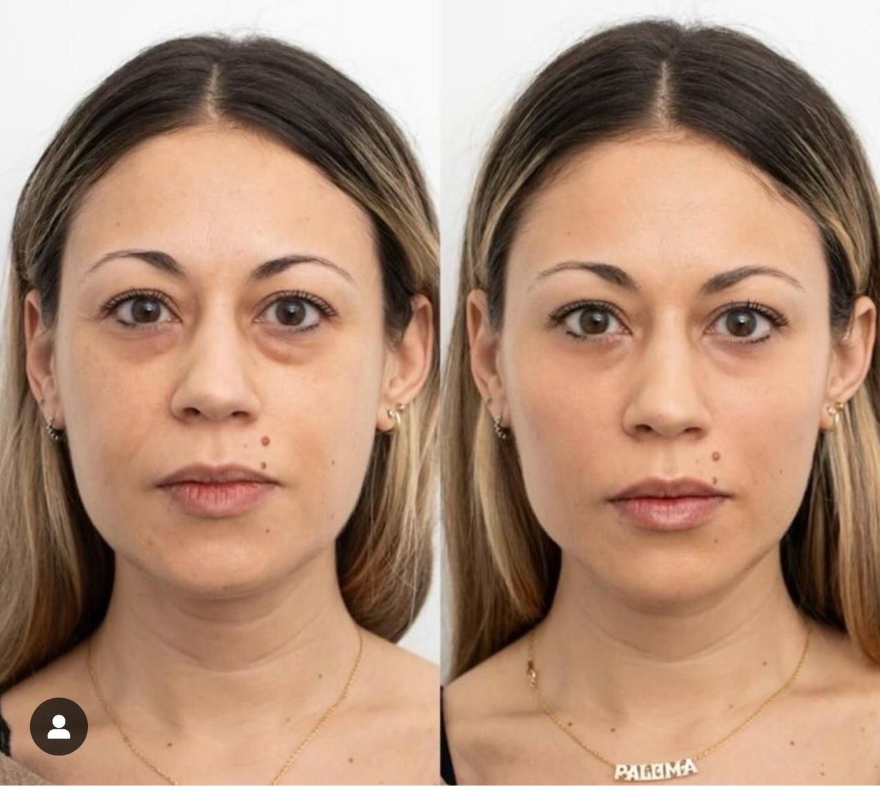 Raquel Moreno Pentinel-68