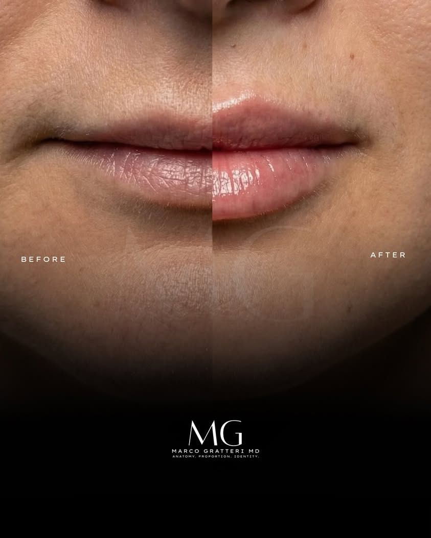 Marco Gratteri-3