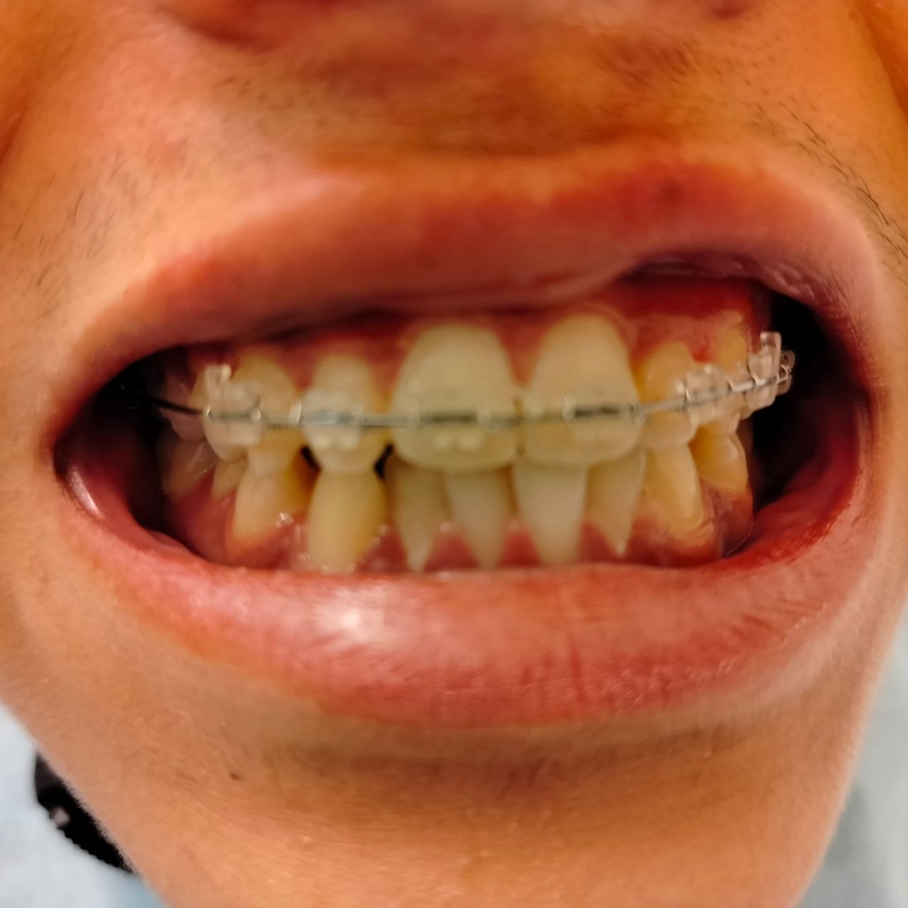 Marco Della Rovere-7