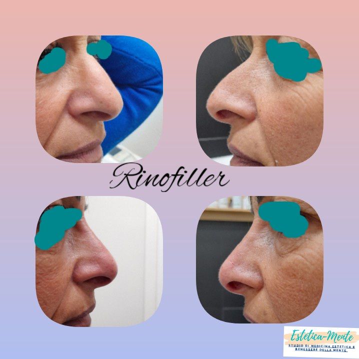 Paola Della Rocca-40