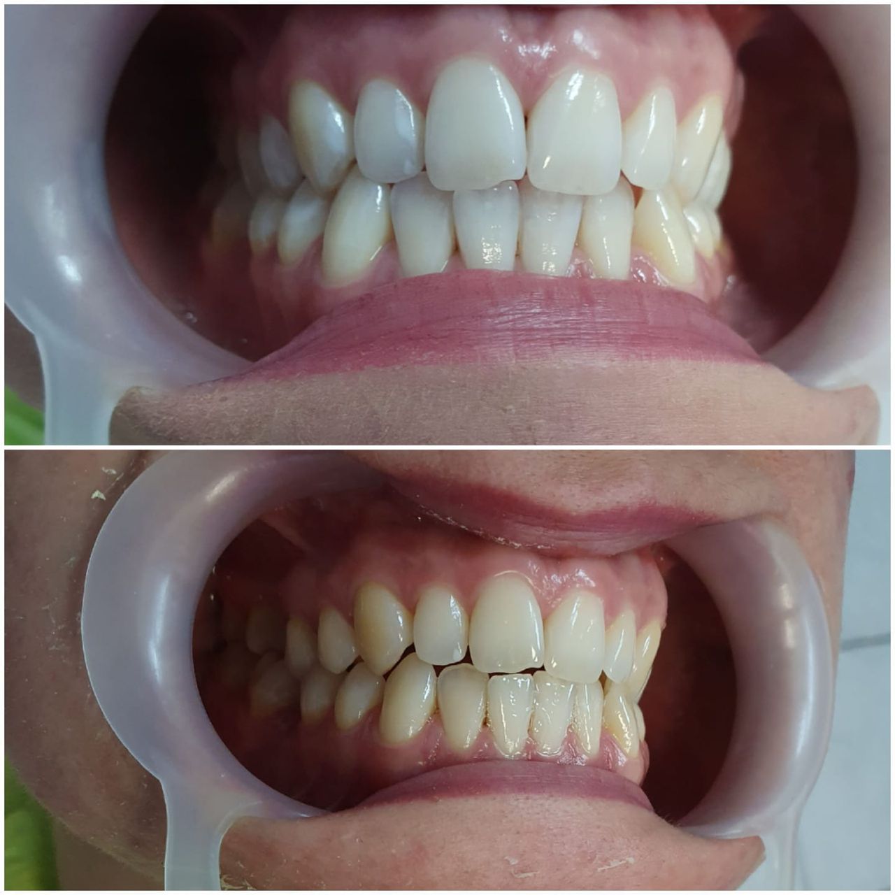 Katarzyna  Kmieć -2