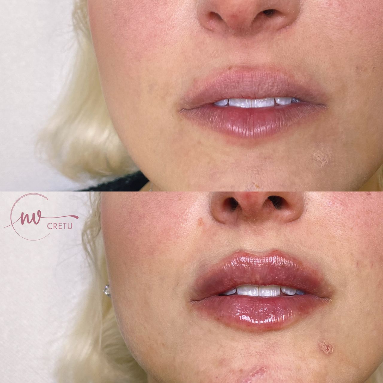 Noemi Virginia Cretu-8