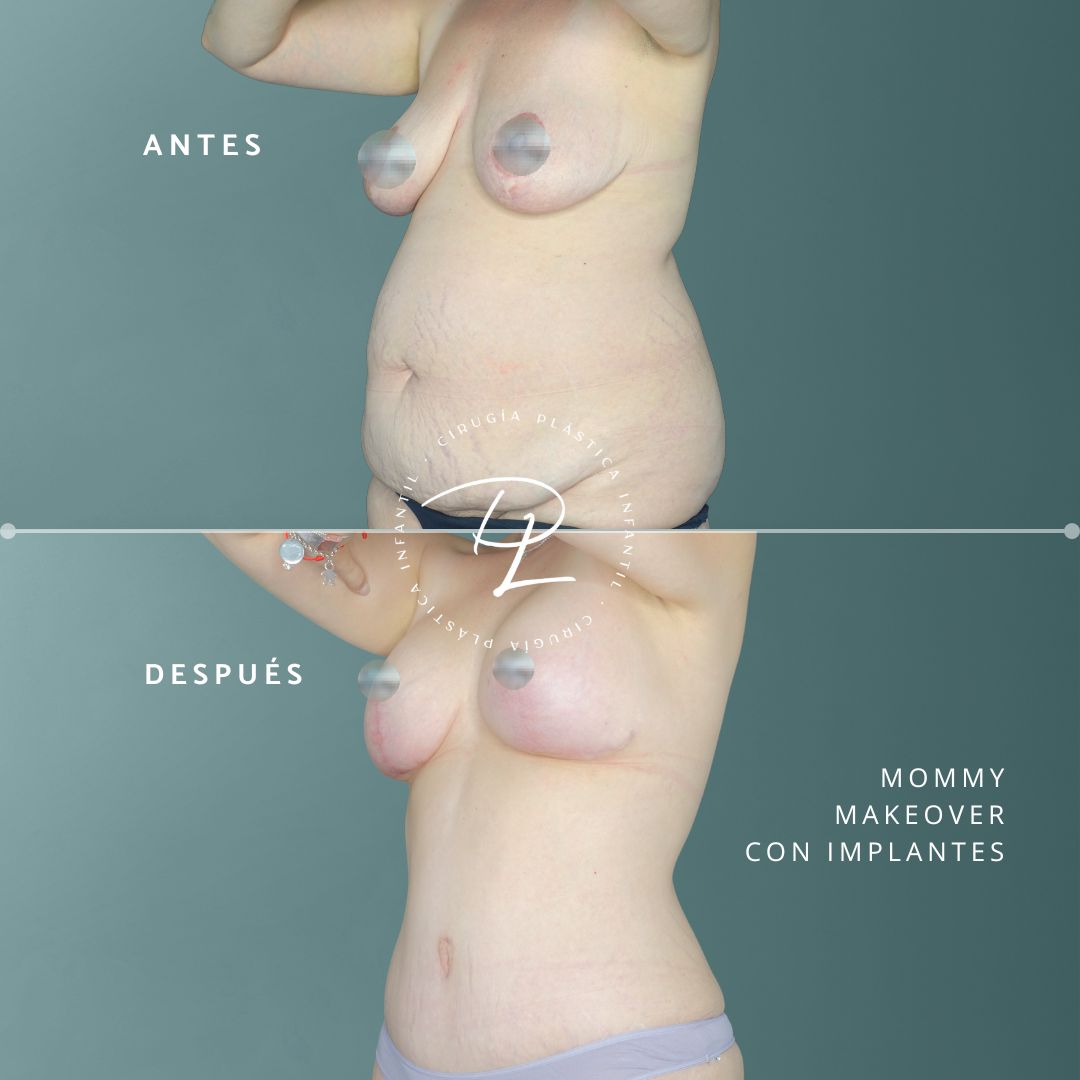 Concepción Lorca García-9