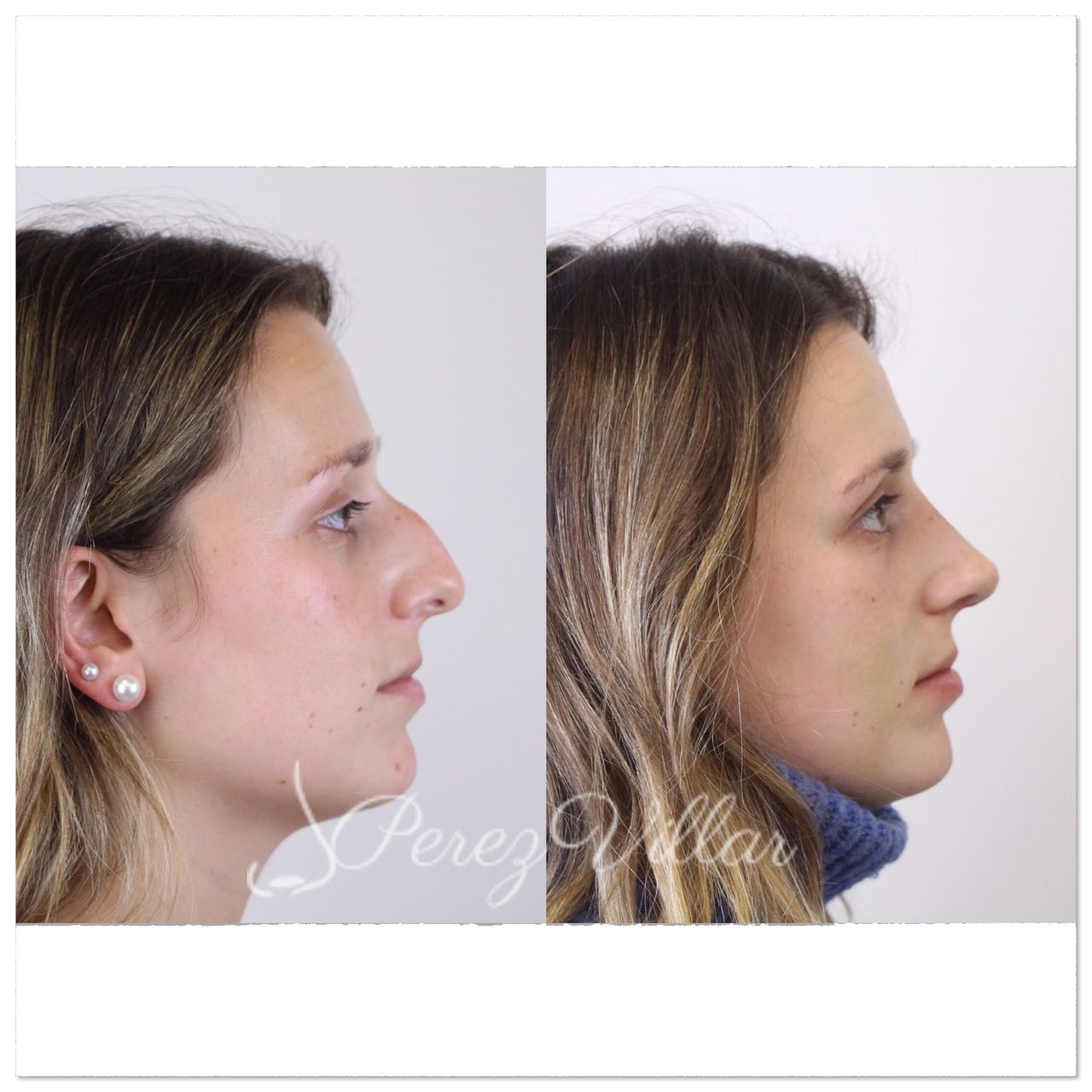 Alvaro Perez Villar-5