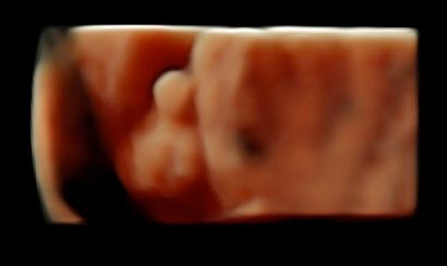 Tommaso Incandela-42