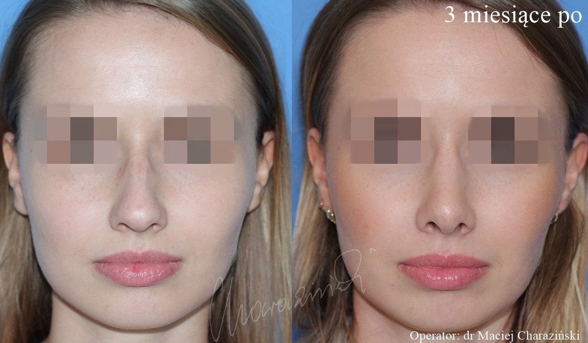 Maciej Charaziński-64