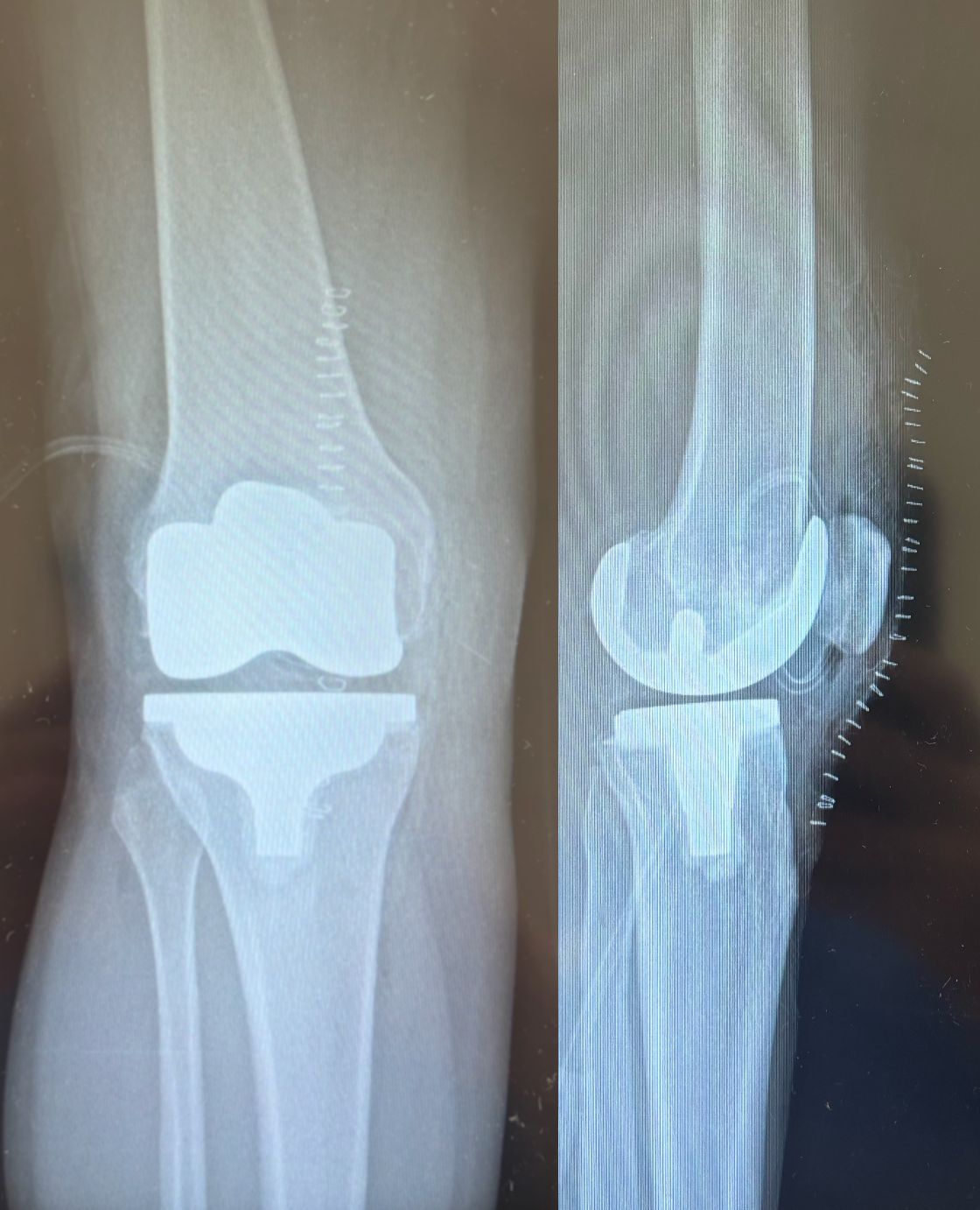 Alessandro Del Monaco-11