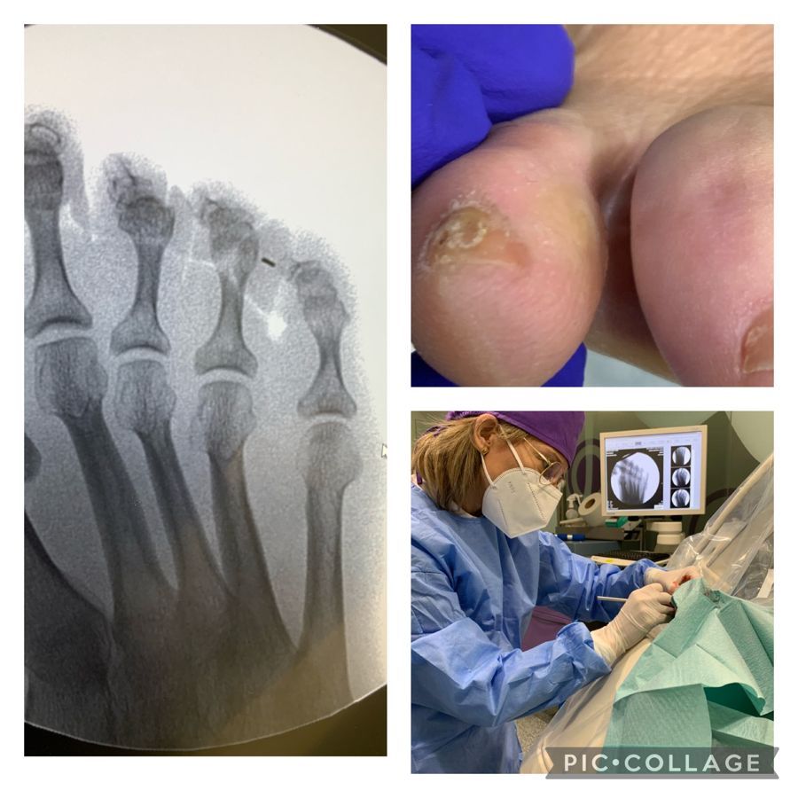 Mercè Garcia Lizandra-21