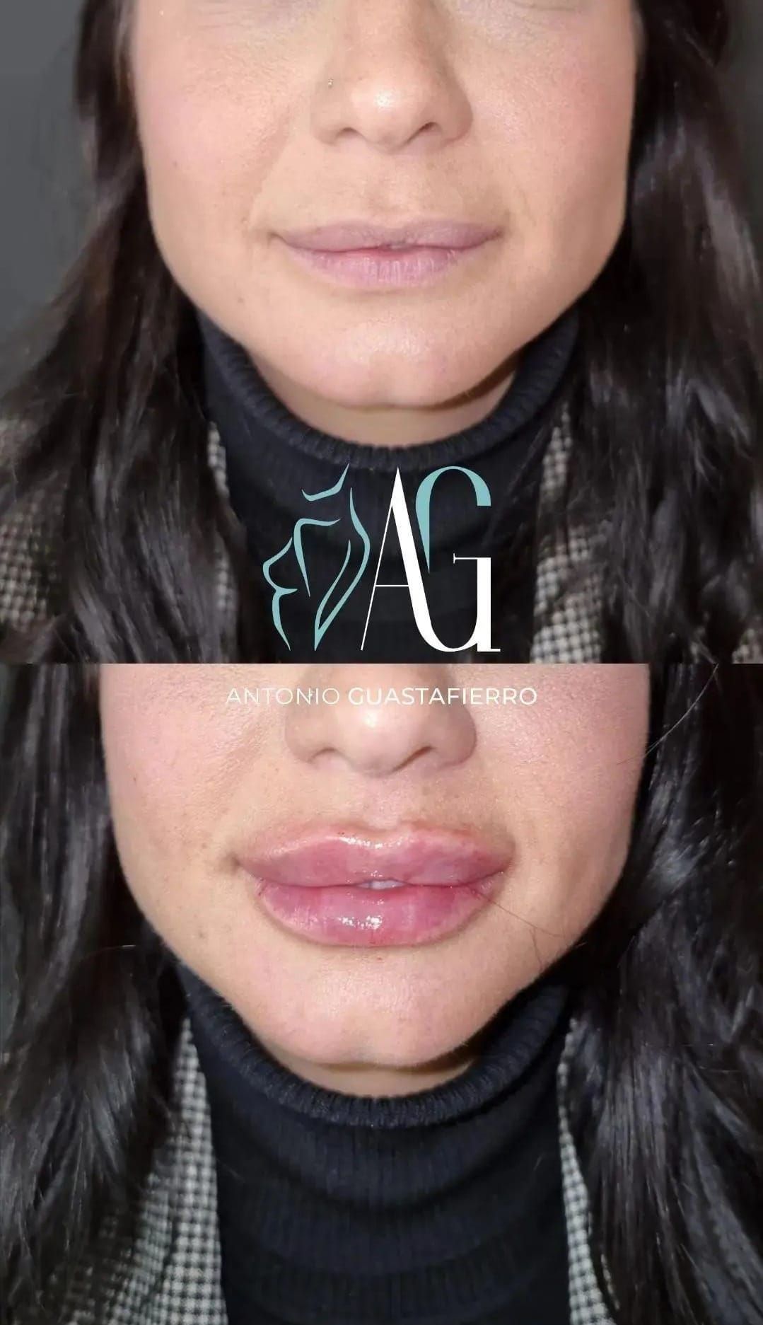 Antonio Guastafierro-13