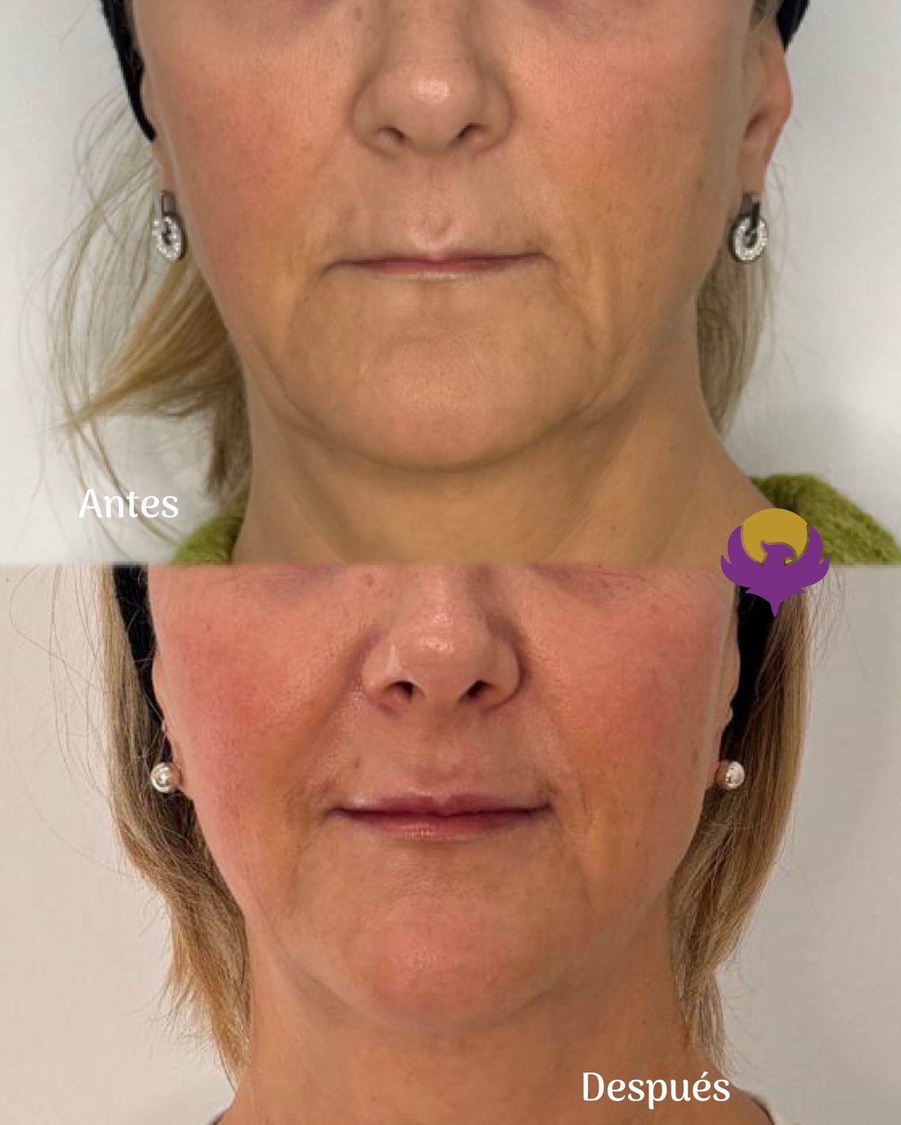 Yessica Corrales Acevedo-7