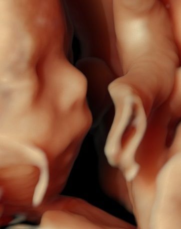 Joanna Krygowska-Zielińska-2