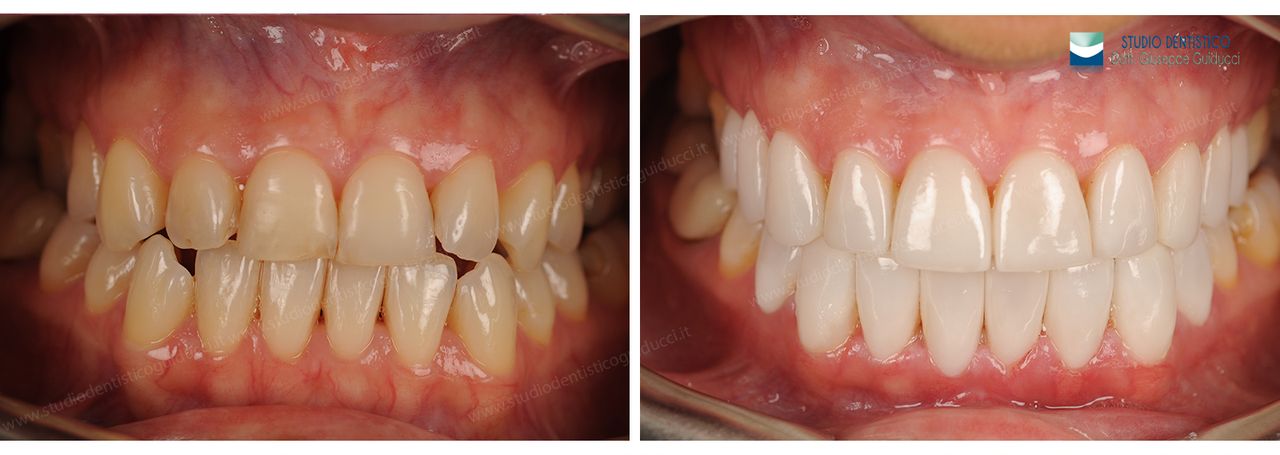 Giuseppe Guiducci-13