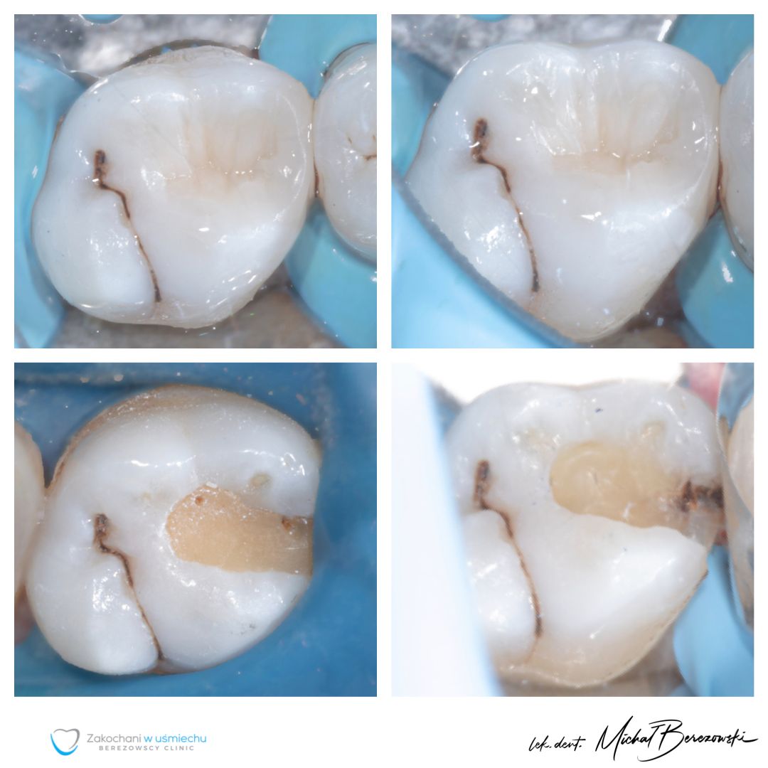 Michał Berezowski-32