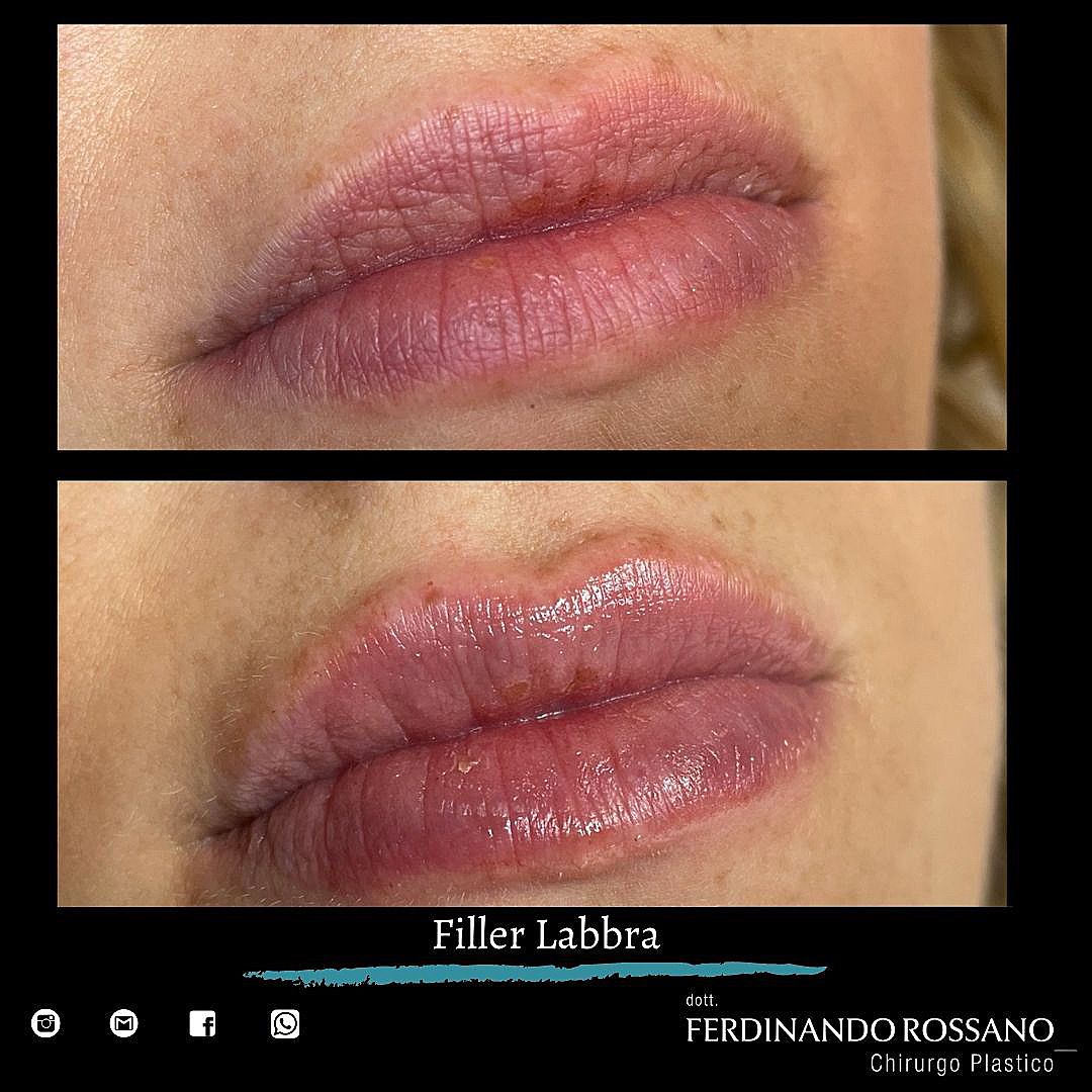 Ferdinando Rossano-3