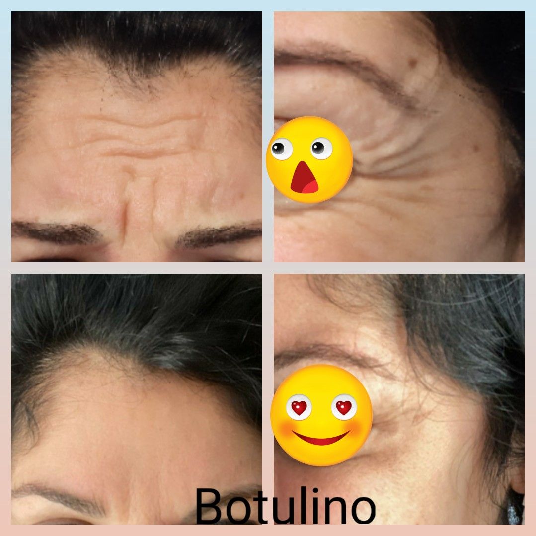 Paola Della Rocca-21