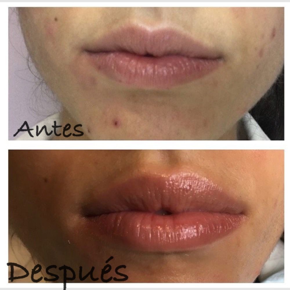 Rafael Gonzalez Oñate-16