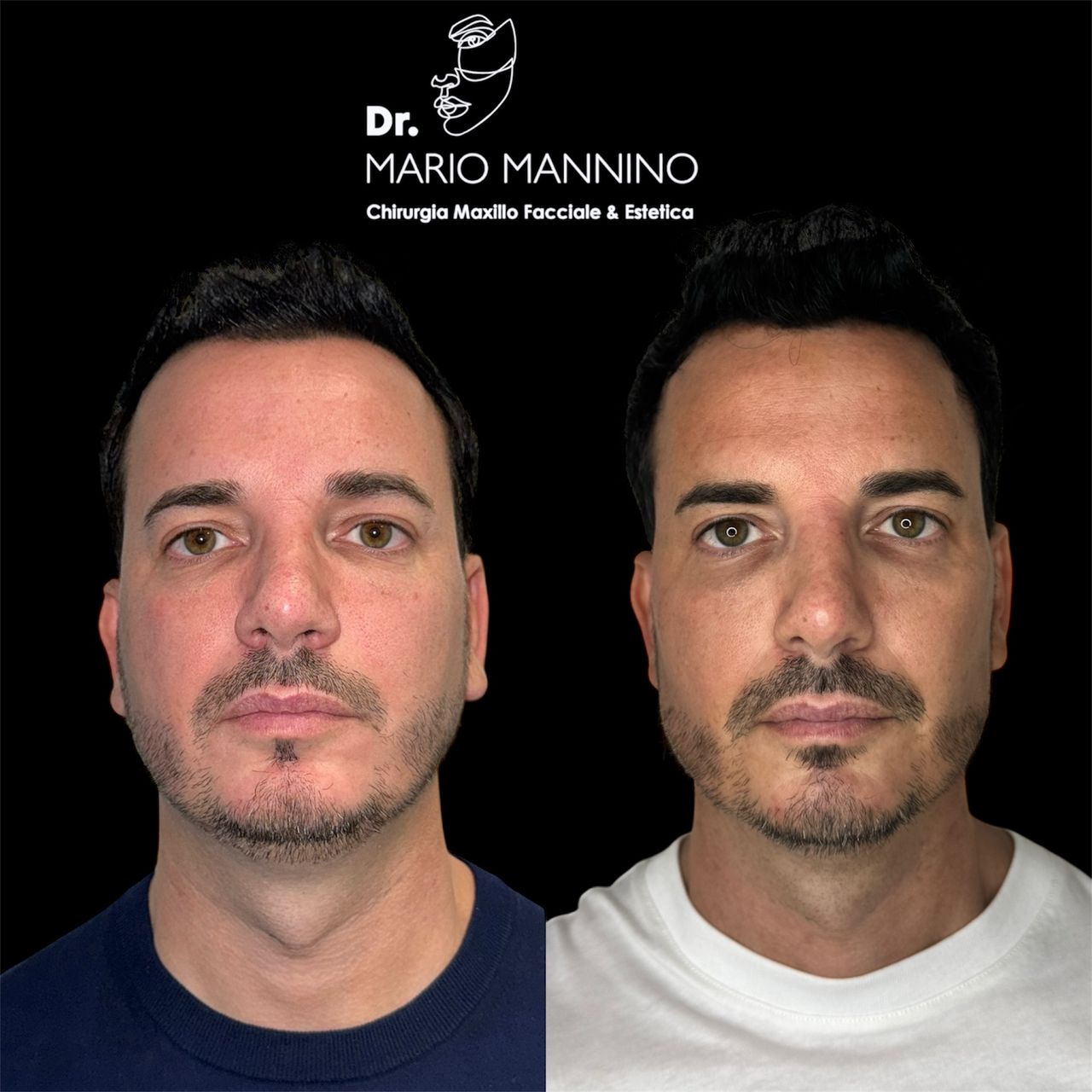 Mario Mannino-19