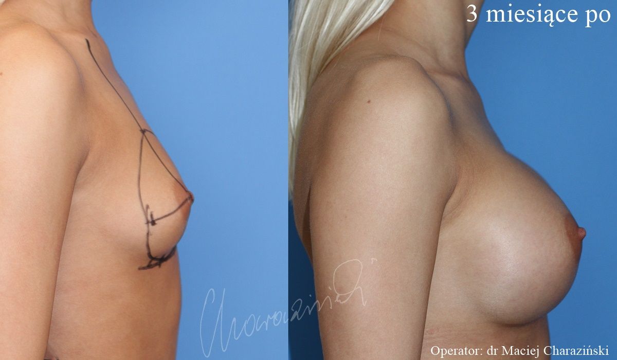 Maciej Charaziński-113