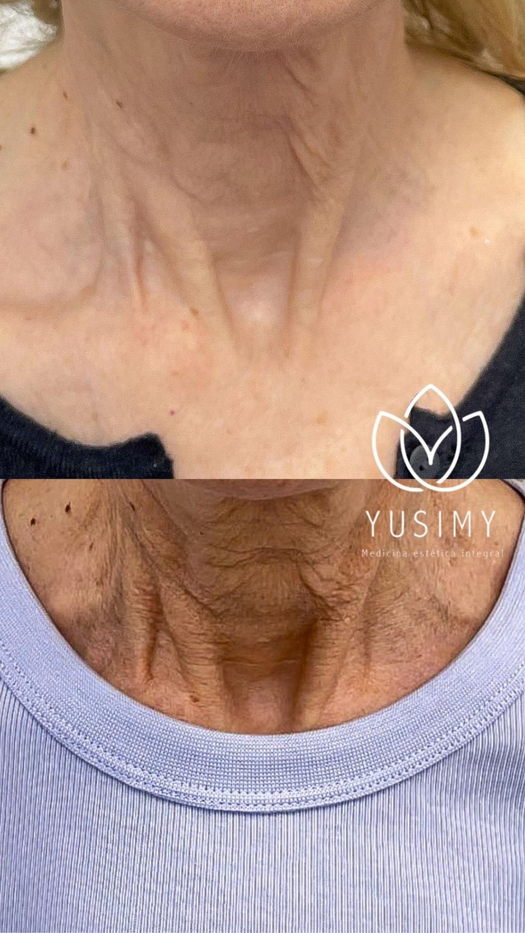 Yusimy Venereo Ramirez-4