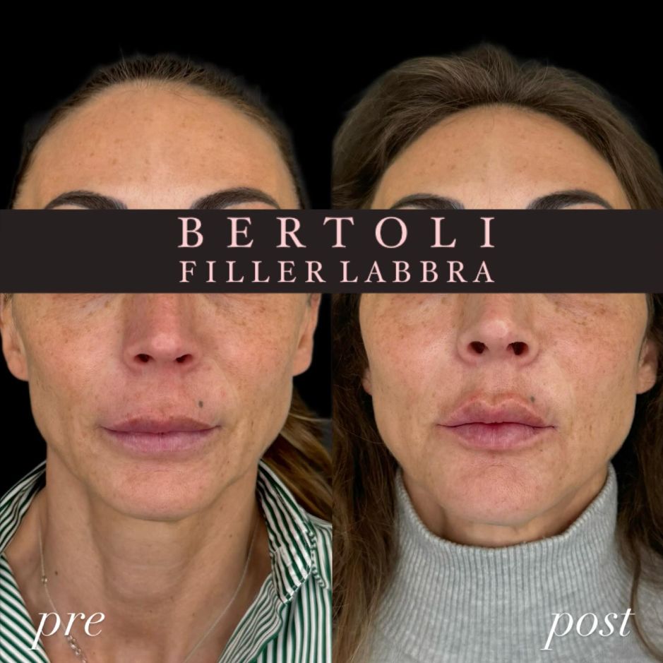 Andrea Bertoli-16