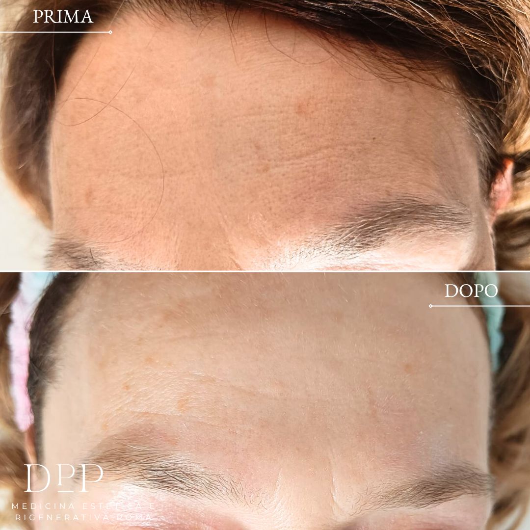 Davide Prosperi Porta-10