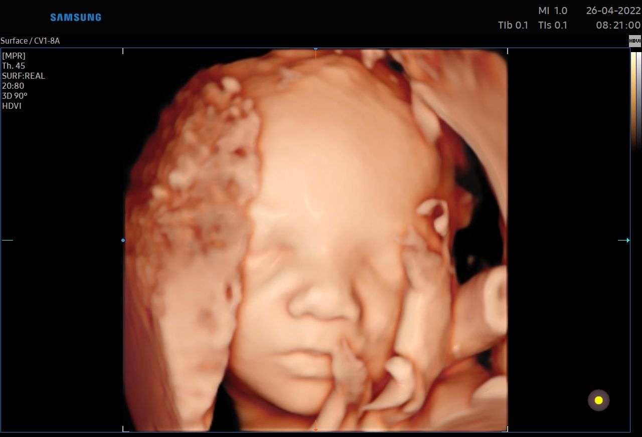 Valentina Conserva-13