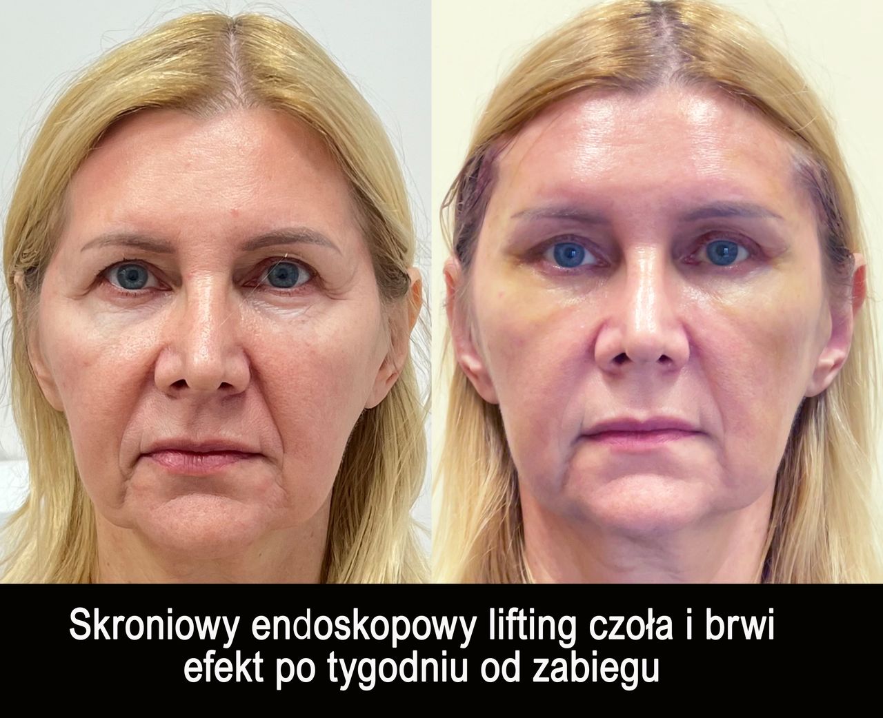 Mariusz Zagajewski-44