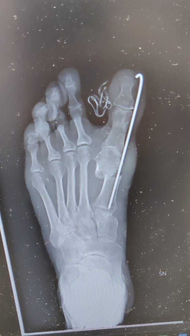 Alessio Giannuzzo-28