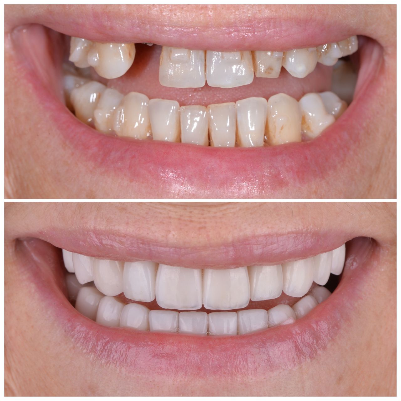 Martin Bartoszcze-43