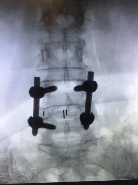 Massimo Brandolin-10