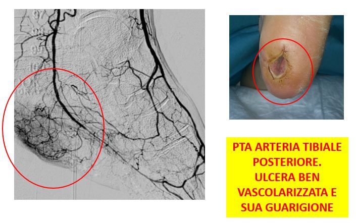 Gianni De Angelis-17