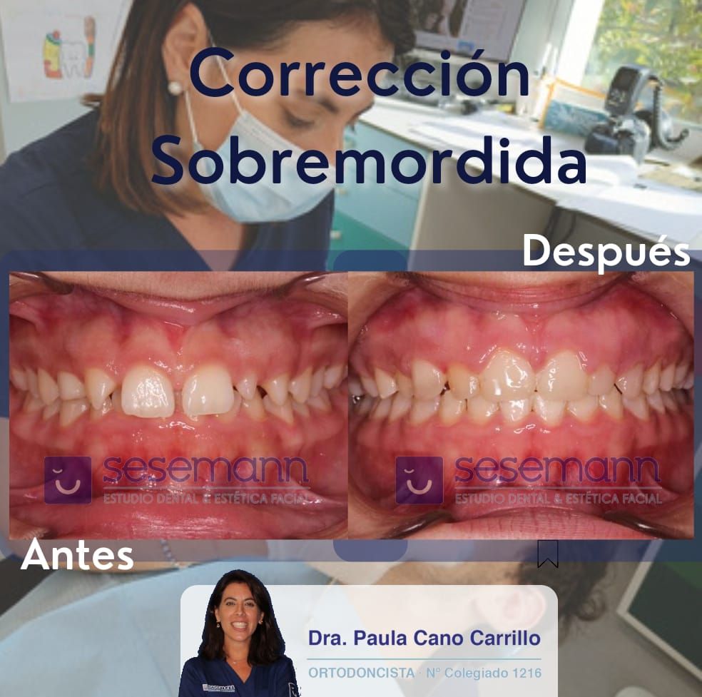 Paula Cano Carrillo-16