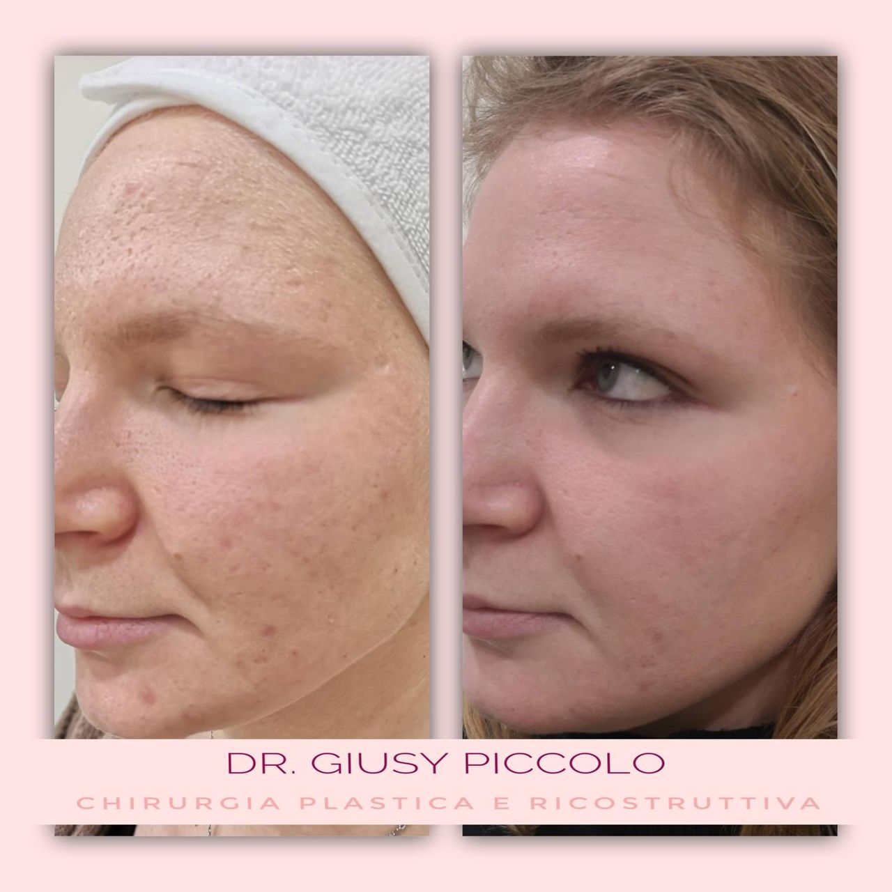 Giuseppina Piccolo-37