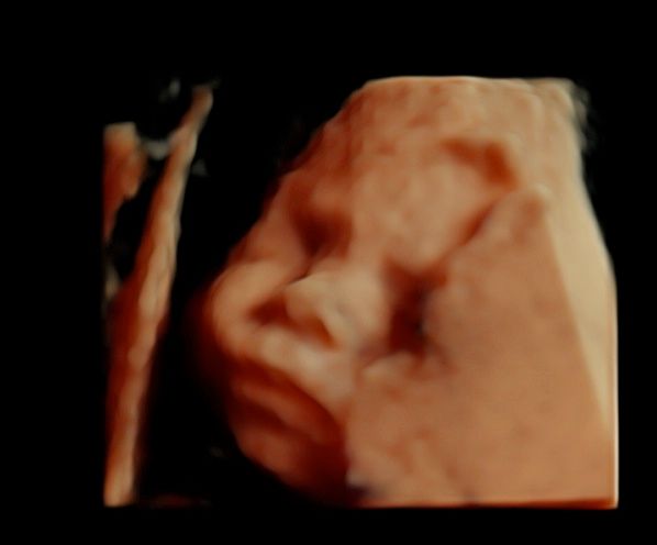 Tommaso Incandela-70