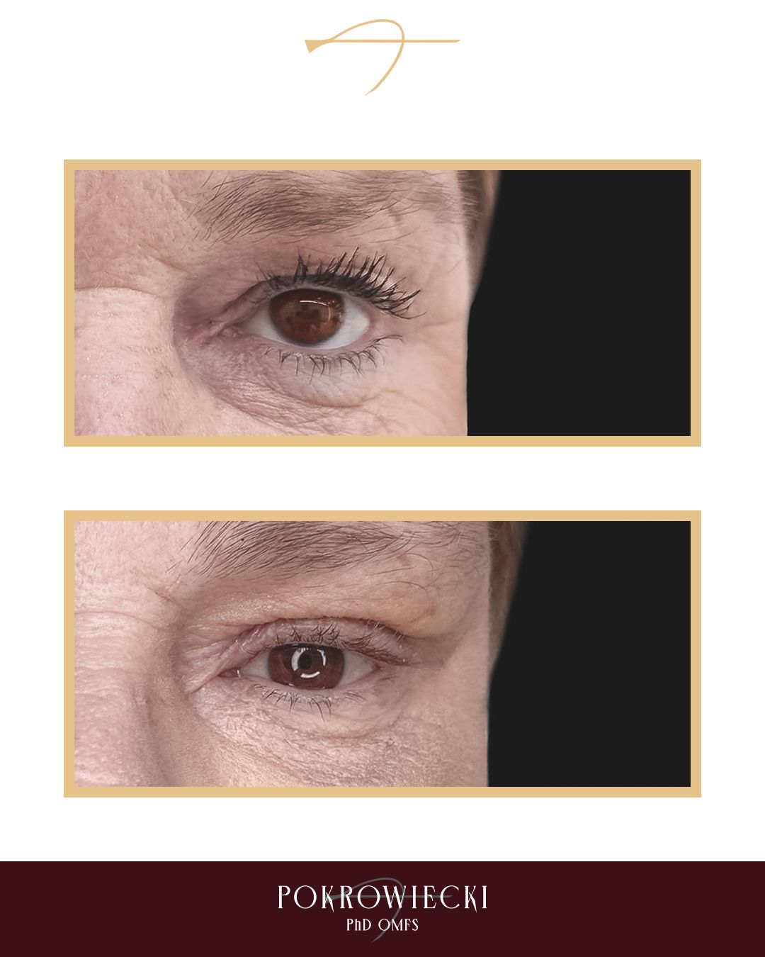 Rafał Pokrowiecki-20