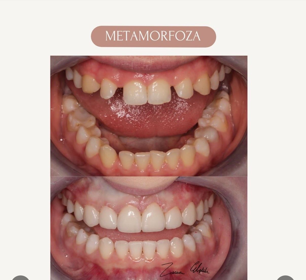 Elżbieta Zalewska-6