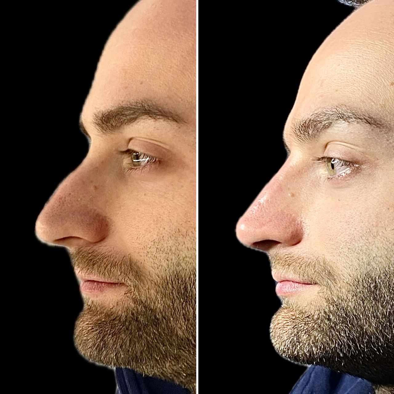 Valerio Lorenzano-11