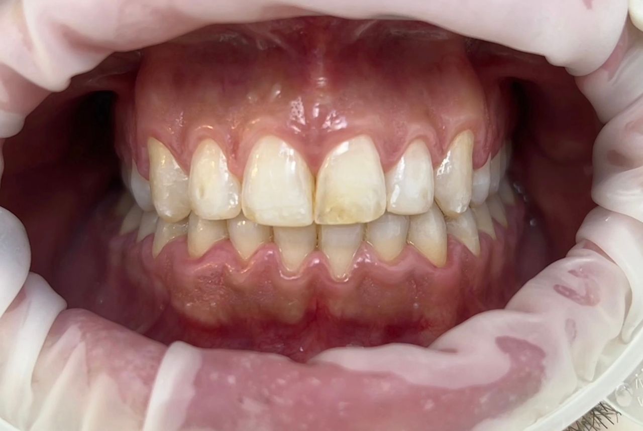 César Buján Riveiro-6