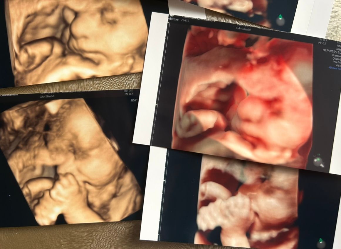 Wioletta Rozmus-Warcholińska-133